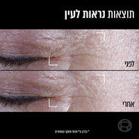 Loreal Age Perfect Cell Renew Midnight Eye Cream 15ml לוריאל דרמו רנסנס מידנייט קרם עיניים-GLAM42