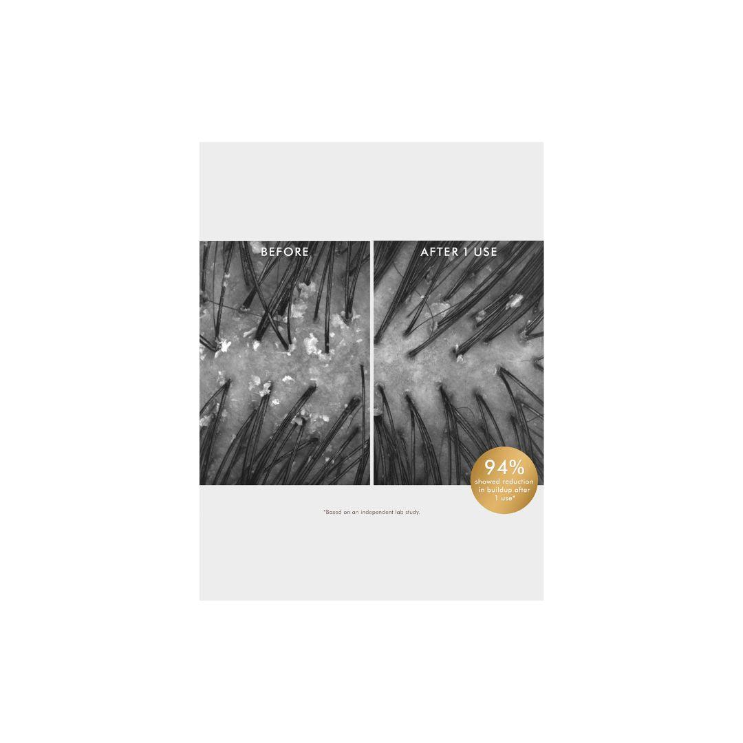 Moroccanoil Purifying Scrub מרוקן אויל פילינג לטיהור הקרקפת-GLAM42