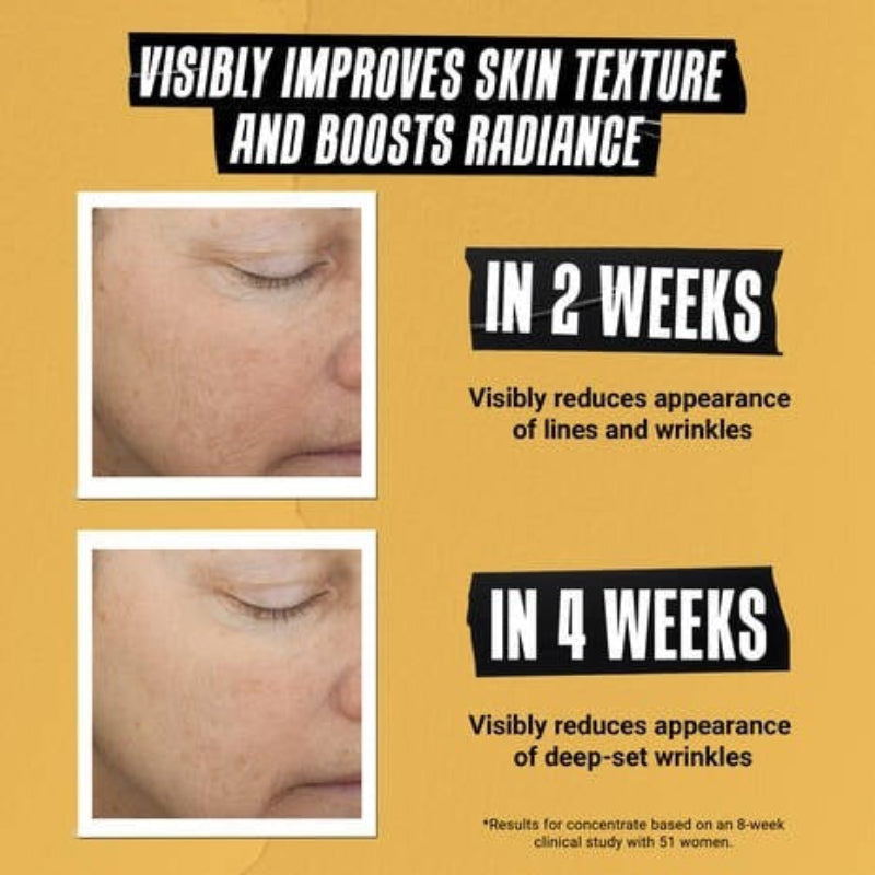 Kiehl's Powerful-Strength Vitamin C Serum קילס סרום ויטמין סי