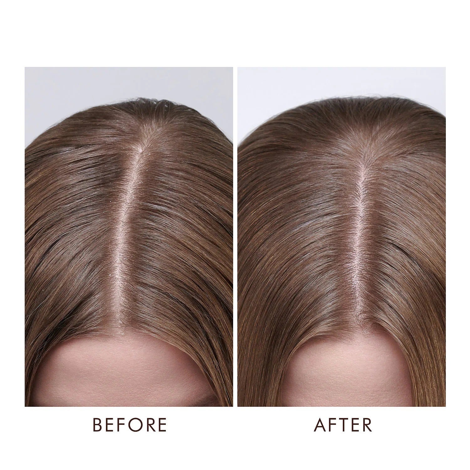 MoroccanOil Dry Scalp Treatment מרקון אויל טיפול לקרקפת יבשה 45 מ"ל