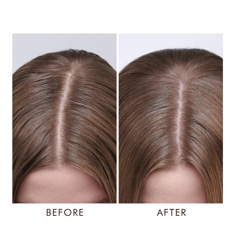 MoroccanOil Dry Scalp Treatment מרקון אויל טיפול לקרקפת יבשה 45 מ"ל