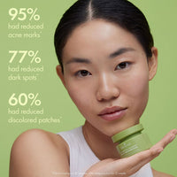 Origins Mega-Mushroom Dark Spot Brightening Moisturizer אוריג'ינס קרם לחות להבהרה ותיקון כתמים